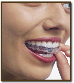 invisalign